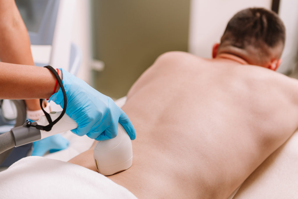 Laser Hair Removal